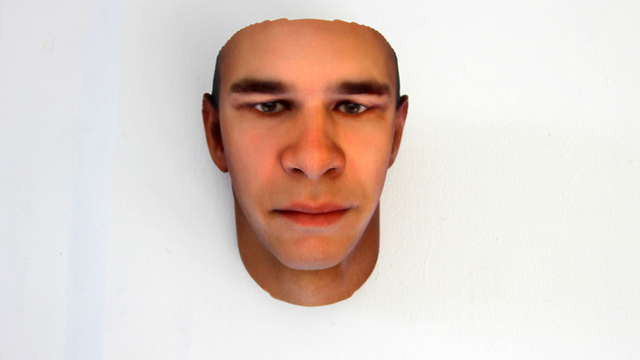 The 3D Printed Prosthetic Face