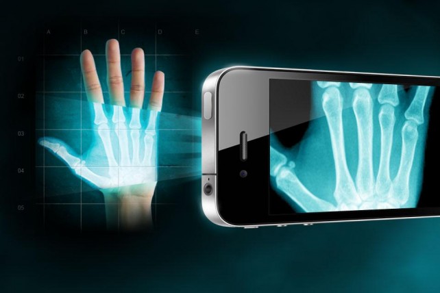 x-ray-iphone