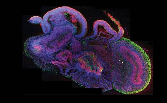 First Miniature Human Brain Grown In Laboratory