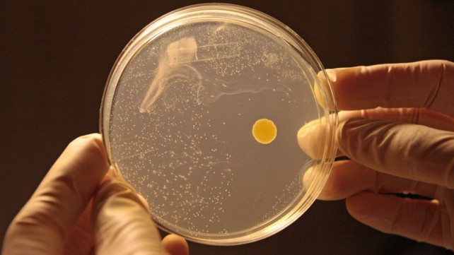 Germ on Petri Dish