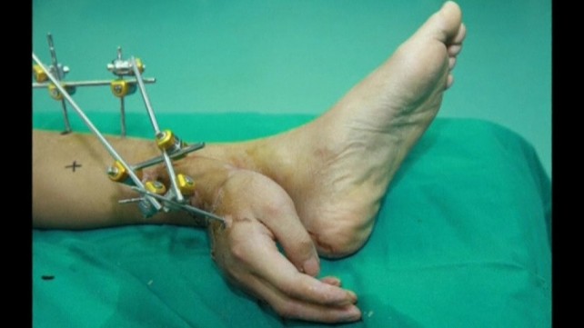 Hand attaached to ankle